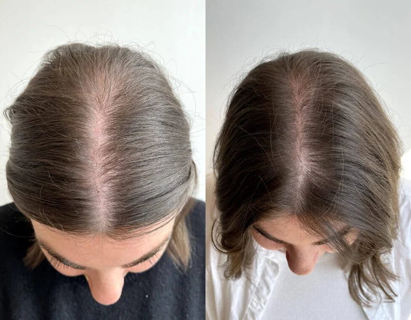 Crowned customer photo showing styled hair with more visible fullness